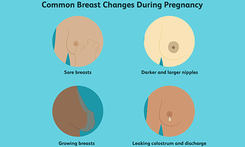Breasts Change Post-Pregnancy