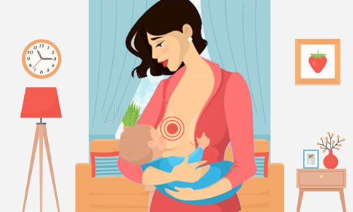 Breast pain Due to Breastfeeding