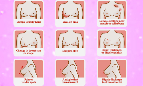 Symptoms Of Breast Cancer