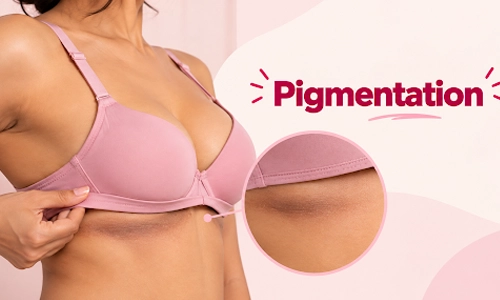  Pigmentation