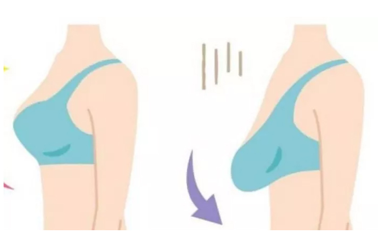 Do push up bras prevent sagging Clearance