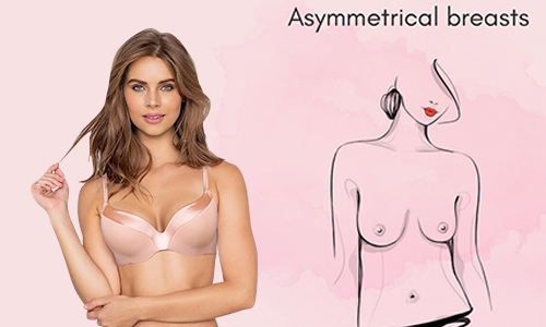  Asymmetric breast shape size