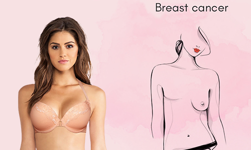 Breast Cancer Mastectomy