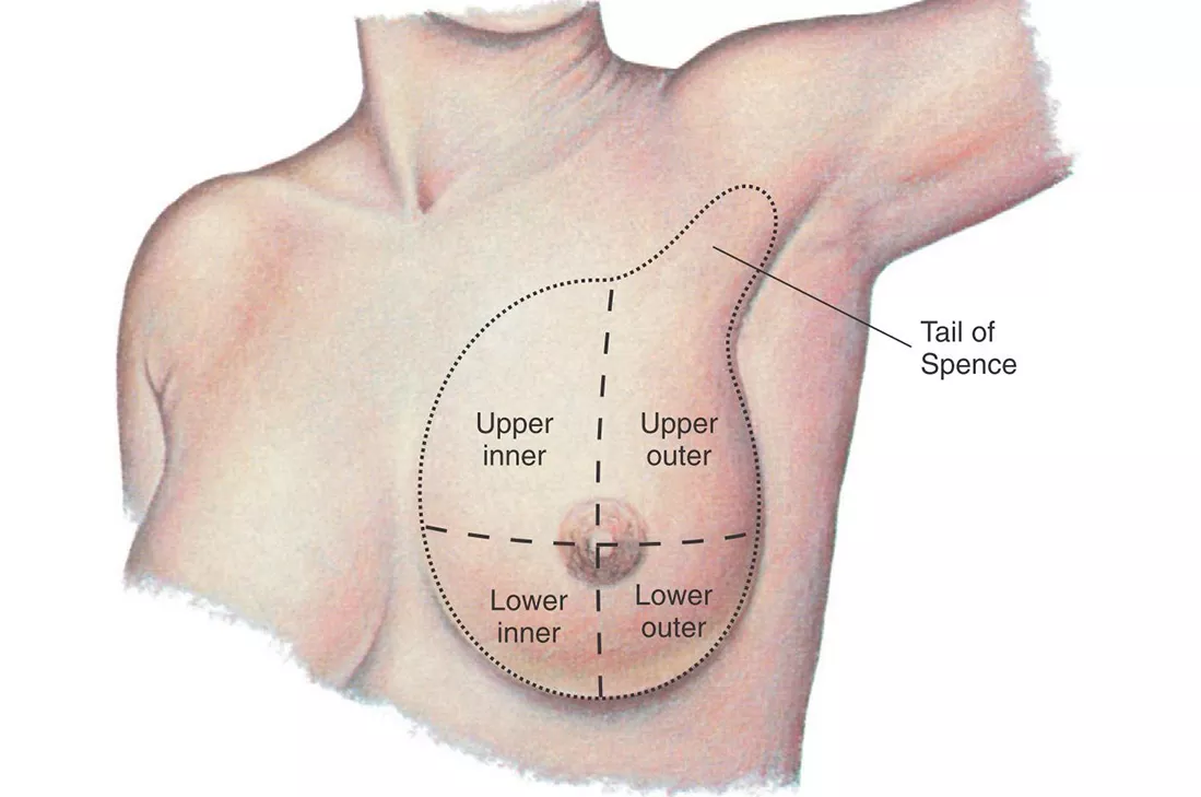 What Are Breast Quadrants and How Does Cancer Affect Them?