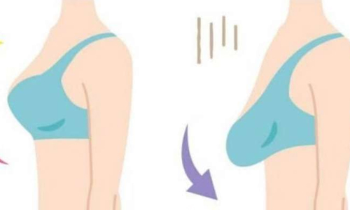 Know About Causes and How to Prevent Sagging Breas