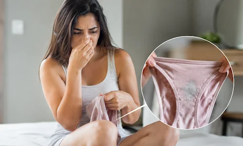 Bacterial Vaginosis