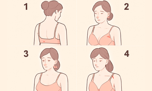 Reasons for Bra Strap Issues