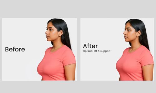 luna bra - before and after 