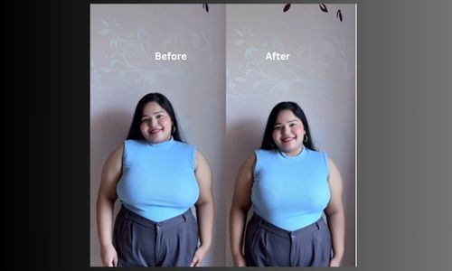 luna bra before and after