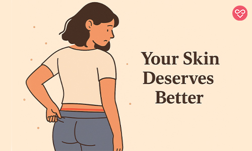 panty elastic mark and skin irritation