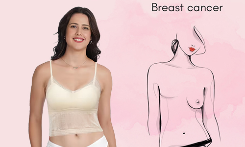  மார்பகப் புற்றுநோய் - மாஸ்டெக்டமி பஸ்ட் (Post-Mastectomy)
