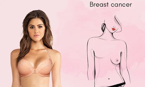 రొమ్ము క్యాన్సర్ - పోస్ట్-మాస్టెక్టమీ బస్ట్